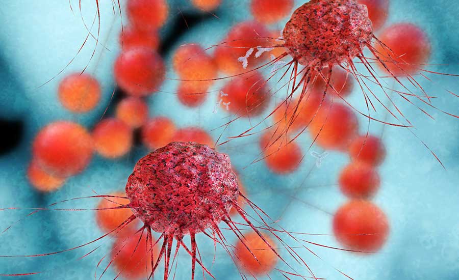 Cancer-cells-Sept-10-2019