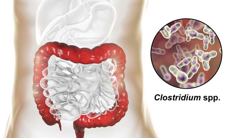 Clostridium-Aug-20-2019